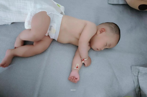 郑州宝宝上火有眼屎